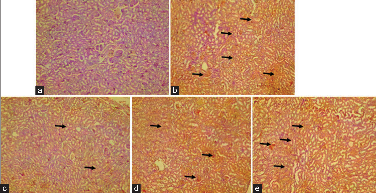 The immunohistochemistry of renal angiotensin converting enzyme. (a) Group A (Control), (b) Group B (Ethanol [EtoH] [40%]), (c) Group C (EtoH [40%] + alpha-tocopherol 2.5 mg/kg), (d) Group D (EtoH [40%] + quercetin 50 mg/kg), and (e) Group E (EtoH [40%] + alpha-tocopherol + quercetin 50 mg/kg). Black arrows indicate immunohistochemical expression of angiotensin converting enzyme. Slides stained with high definition hematoxylin. (Magnification ×100).